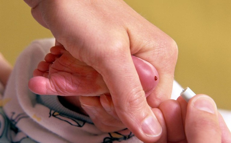 Heel-prick testing for rare muscle-wasting condition begins in NHS trial